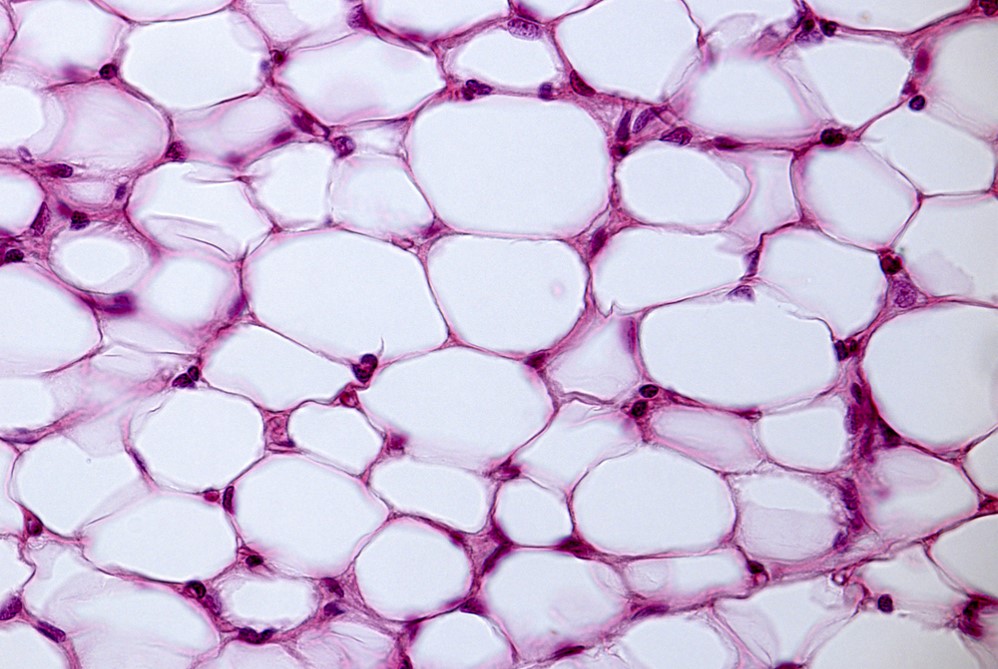 Oxidized linoleic acid metabolites produced during lipolysis modulate adipose tissue.